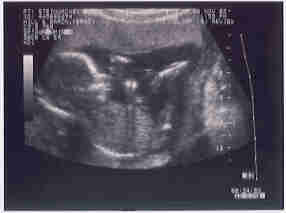 ultrasound.jpg